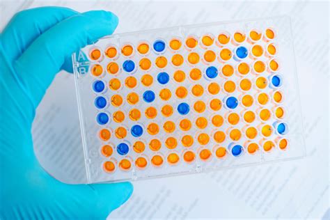 test elisa 5 semaines|que es prueba elisa.